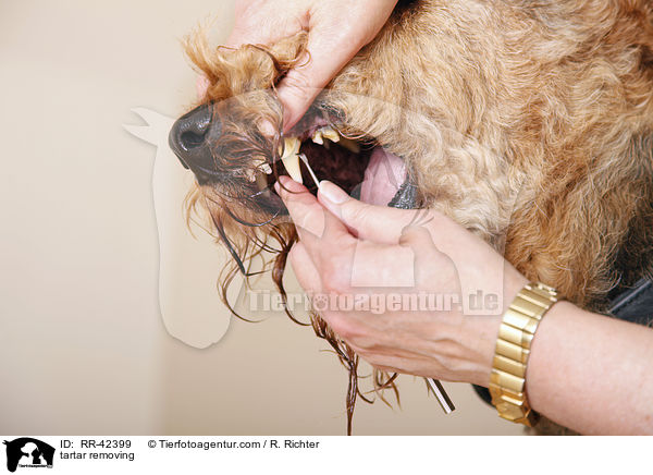 Zahnsteinentfernung / tartar removing / RR-42399