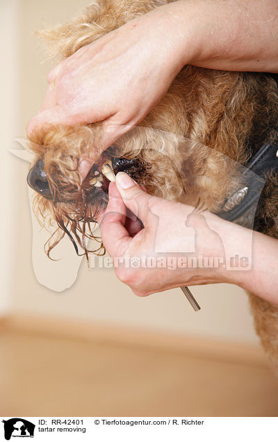 Zahnsteinentfernung / tartar removing / RR-42401