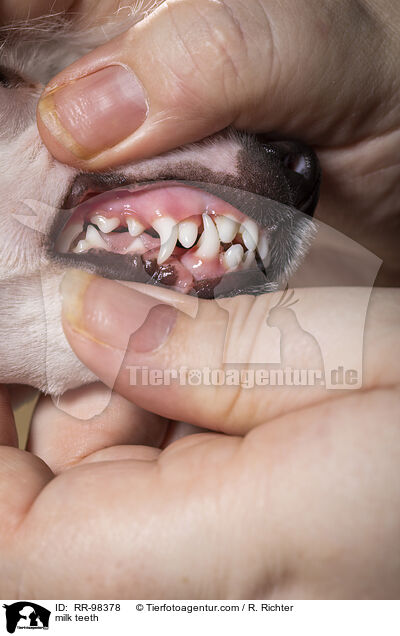 Milchgebiss im Zahnwechsel / milk teeth / RR-98378