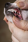 milk teeth
