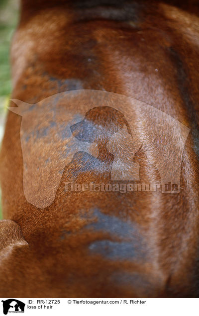 Haarausfall / loss of hair / RR-12725