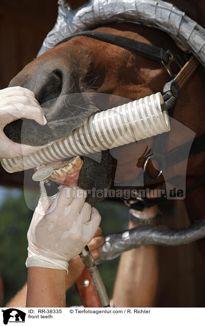 Frontzhne abschleifen / front teeth / RR-38335