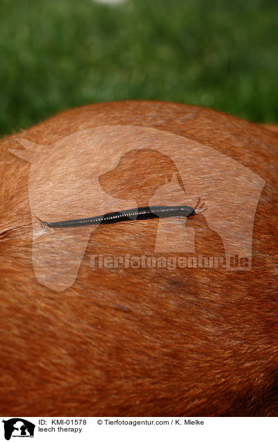 Blutegeltherapie / leech therapy / KMI-01578